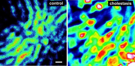 Intravital Microscopy Helps Image Hepatic Excretory Function during Cholestasis